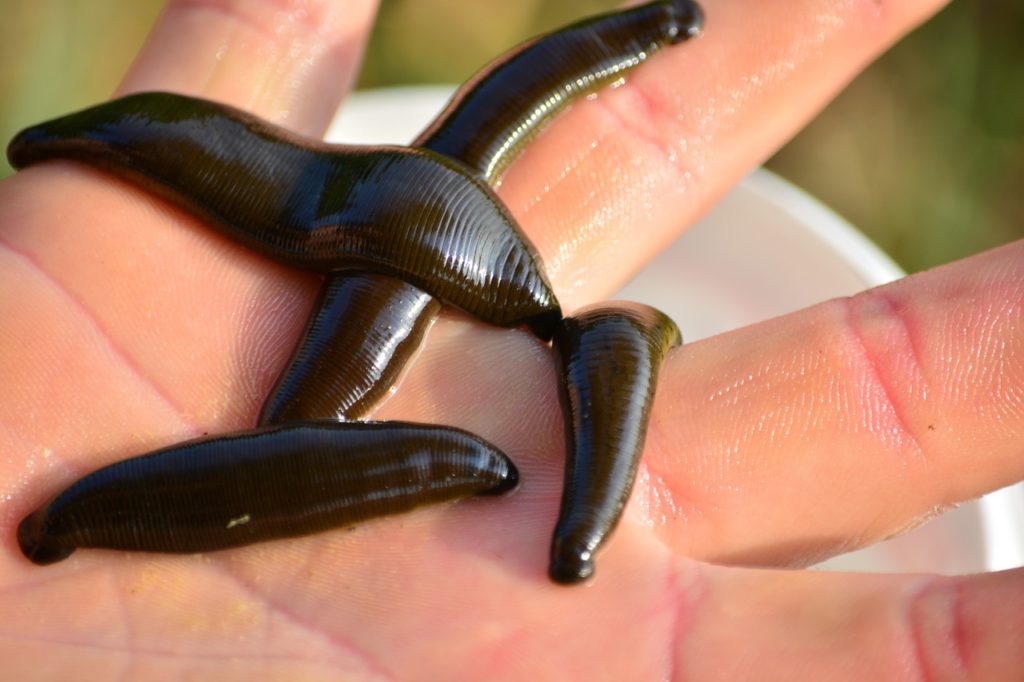 Leeches on a hand (closeup)